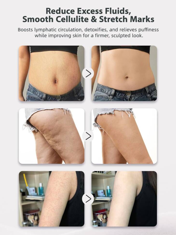 Anti-Cellulite Lymph Sculpt Massager - Image 5